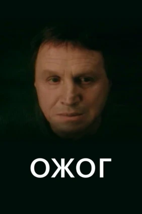 Ожог