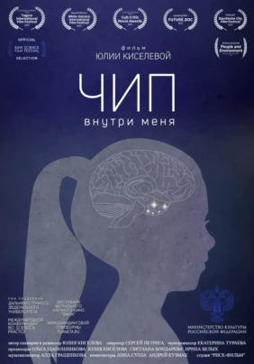 Чип внутри меня