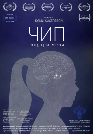Чип внутри меня
